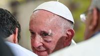 Pope Francis bruises face on Visit to Colombia ⋆ 2CNewsBlog